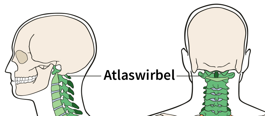 Atlaswirbel